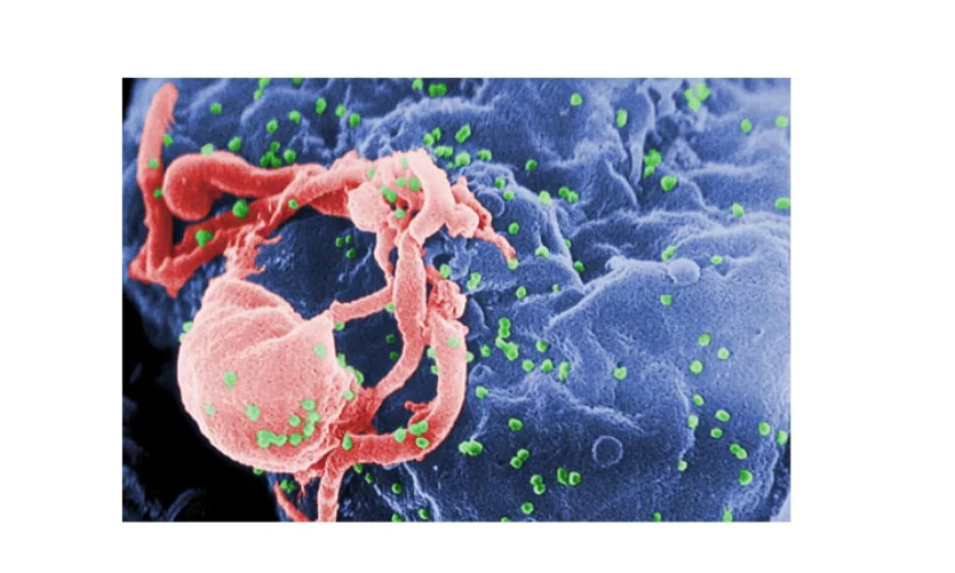 Guinea Faces HIV Drug Shortage, Government Warns