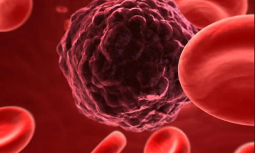Global Liver Cancer Cases Projected to Double, Majority Preventable: Study