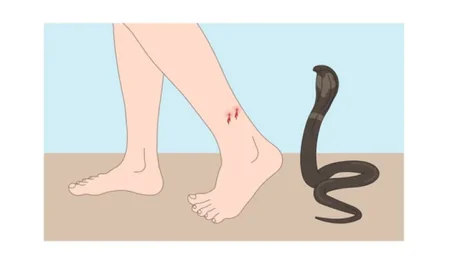 12‑Year‑Old Madrasah Student Succumbs to Snakebite in Naogaon